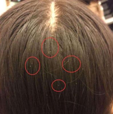 魔兽世界哪里买血虱？（我的世界哪里会有虱子呢）